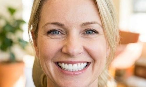 Invisalign – 8 maanden